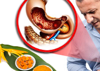 Công dụng tuyệt vời từ nghệ vàng trong chữa bệnh viêm loét dạ dày